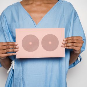 Why breast cancer is more deadlier for black women: Physicians