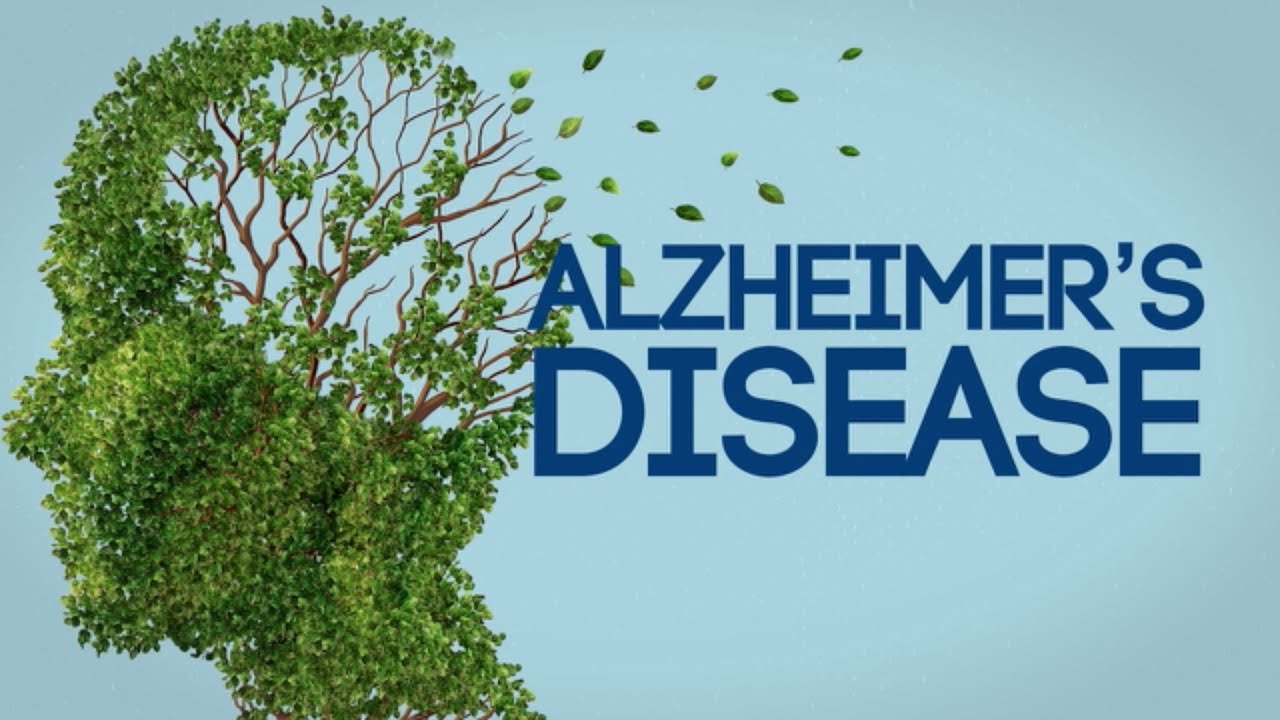 Treating Alzheimer Disease Costs Two Million Dollars Annually- Expert