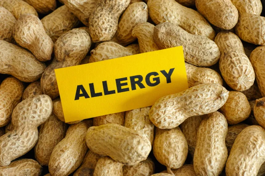 Unlocking Food Safety: Strategies to Safeguard Against Peanut-Induced Allergic Reactions in Ready-Made Foods