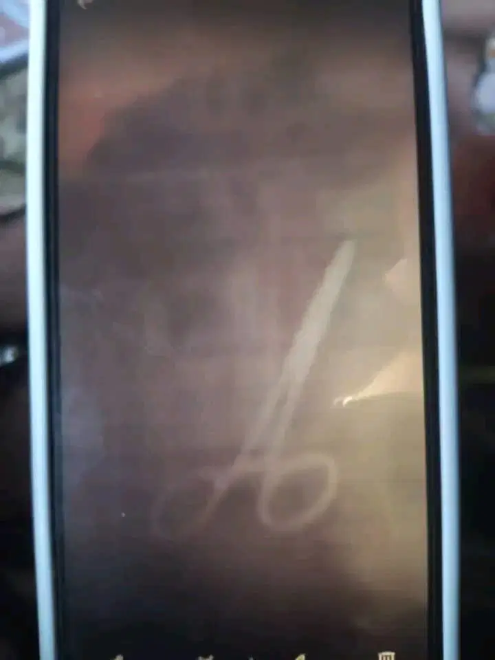 Kano Doctors Suspended After Scissors Left Inside Patient’s Body: Lessons in Hospital Negligence